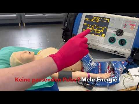 HowTo Externer Herzschrittmacher, tranthorakales Pacing